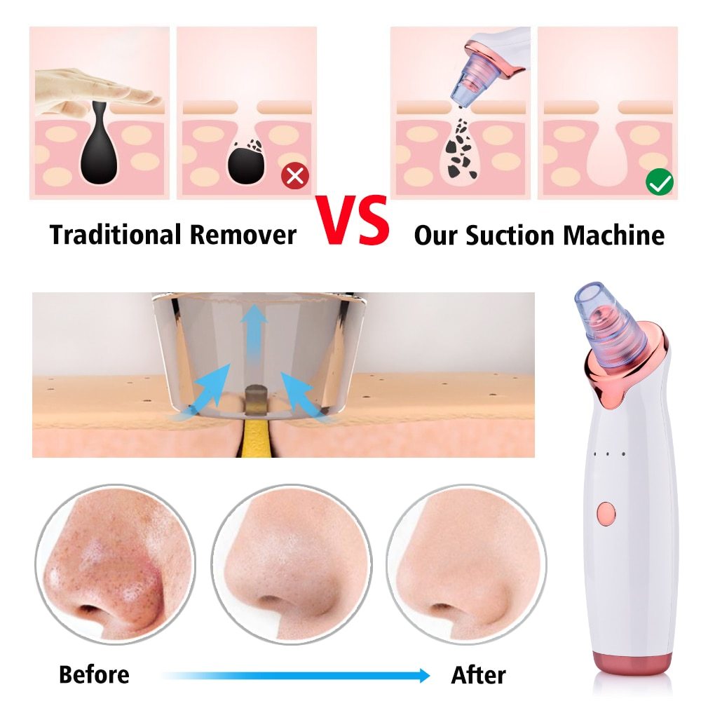 Blackhead Instrument Electric Suction Facial Washing Instrument Beauty Acne Cleaning Blackhead Suction Instrument - Image 8